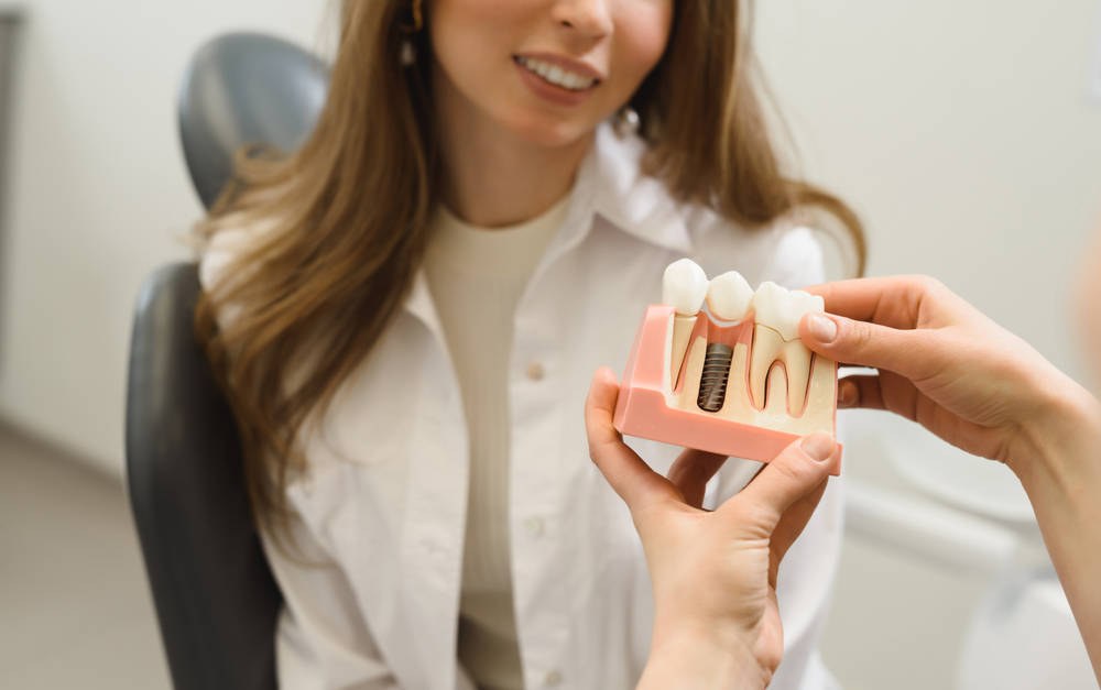 Lo que debes saber antes de elegir un especialista en implantes dentales